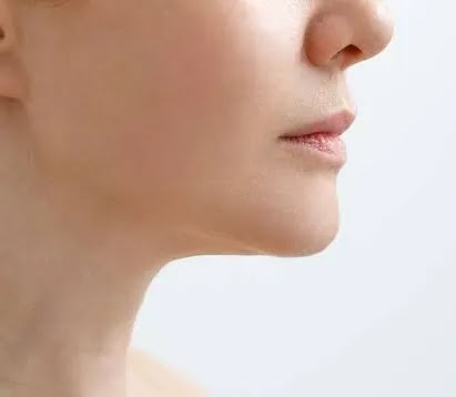 After using Refirmance Serum