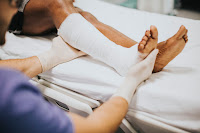 doctor applying plaster of paris  on left leg of a man