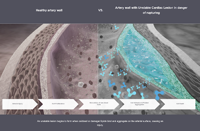 mRNA vaccines and Cardiac