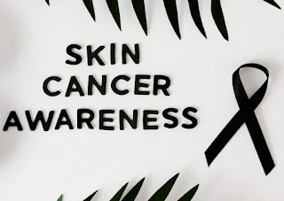 How fast does skin cancer grow?_ ichhori.com