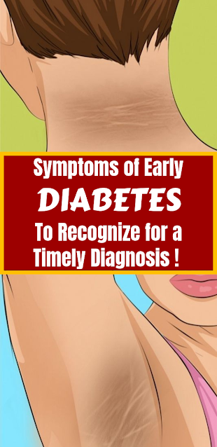 Symptoms of Early Diabetes to Recognize for a Timely Diagnosis !