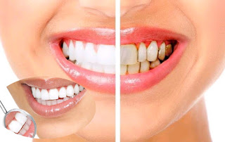 daily white fusion teeth whitening foam