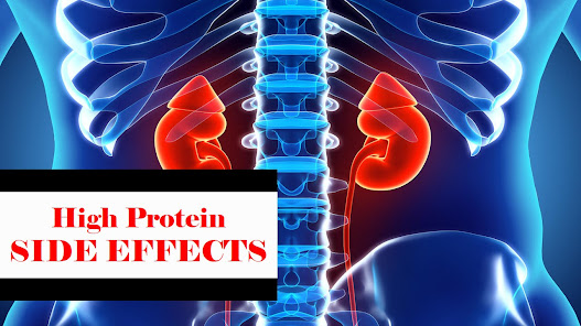 High protein side effect | Whey protein side effects