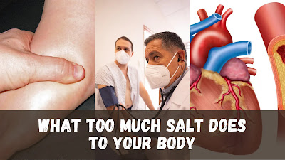 What Too Much Salt Does to Your Body