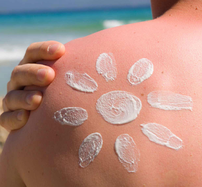 Beauty Care for Sunburned Body