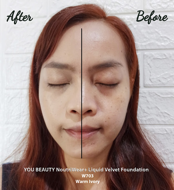 Before after review YOU Foundation