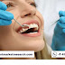 Global Cosmetic Dentistry Market To Be Driven At A CAGR Of 6.2% In The Forecast Period Of 2022-2027
