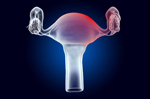 endometriosis treatment,adenomyosis,ivf treatment,causes and treatment of heavy menstrual bleeding,#adenomyosis,adenomyosis telugu,ivf treatment cost,precautions for fibroids and adenomyosis patients,adenomyosis and pregnancy telugu,adenomyosis and covid vaccine,eucorrhea home treatment,ivf treatment for pregnancy video,ivf infertility treatment,complications of endometriosis,ivf treatment means,ivf treatment for pregnancy,how to ivf treatment in hindi