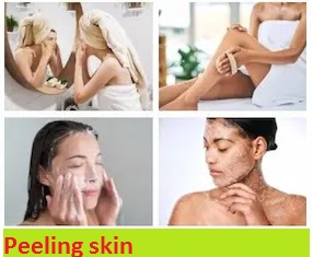 Peeling skin