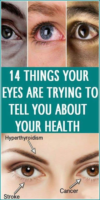 14 Things Your Eyes are Trying to Tell You About Your Health