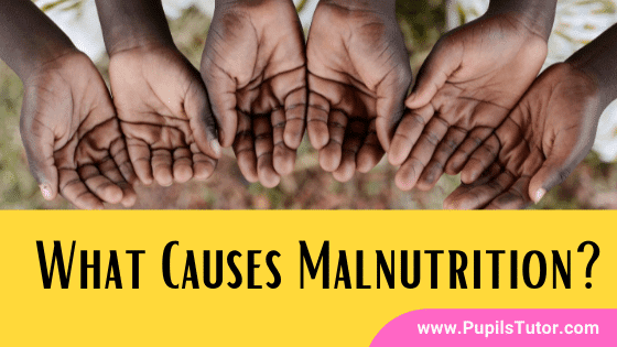 What Is Malnutrition And Its Causes? | 11 Most Common Causes And Reasons For Malnutrition | Malnutrition Meaning | What Are The Causes Of Malnutrition - www.pupilstutor.com