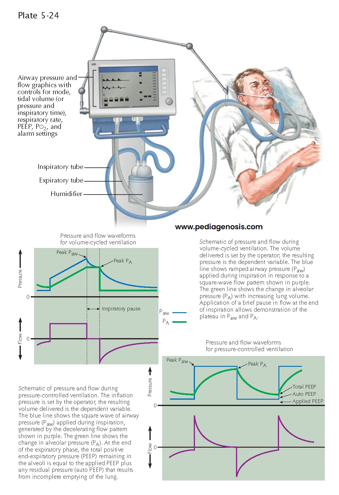 MECHANICAL VENTILATION