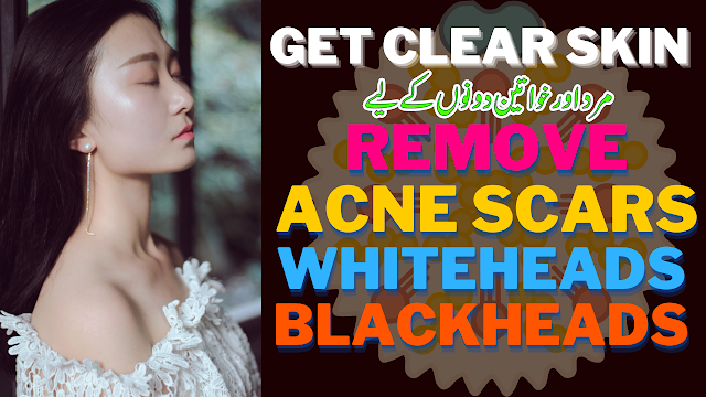 Can Acne Scars Be Removed Naturally?