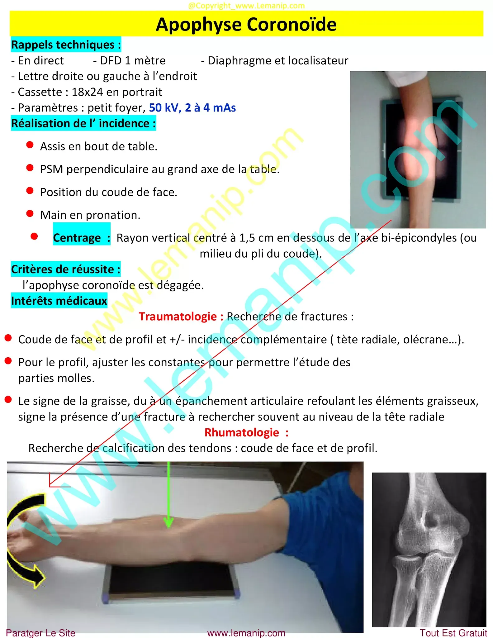 avant bras,elbow pain orthopedic doctor,dr henry hand and wrist,elbow pain treatment near me,premier orthopedics hand specialist,bras avant,hand man,orthopedic hand,orthopedic wrist,orthopedic elbow,orthopedic carpal tunnel