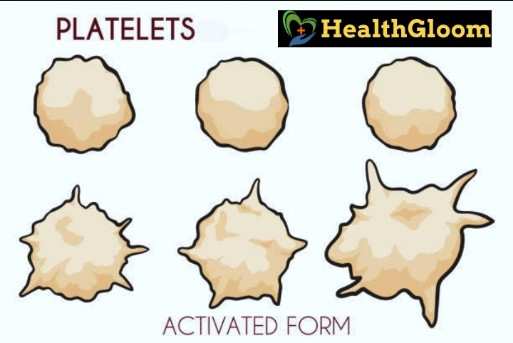Platelets | low platelets count | low platelets count symptoms | Low platelets Causes