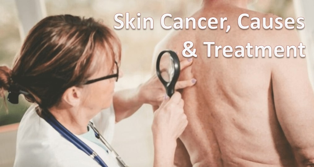 Know The Skin Cancer and Treatment