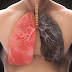 RESPIRATORY SYSTEM PATHOLOGIES:DISEASES THAT AFFECT THE LUNGS.