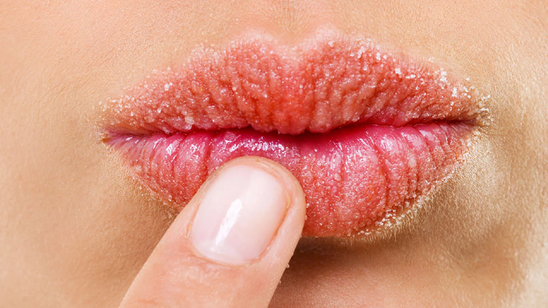 6 Causes of Dry Lips and How to Prevent Them