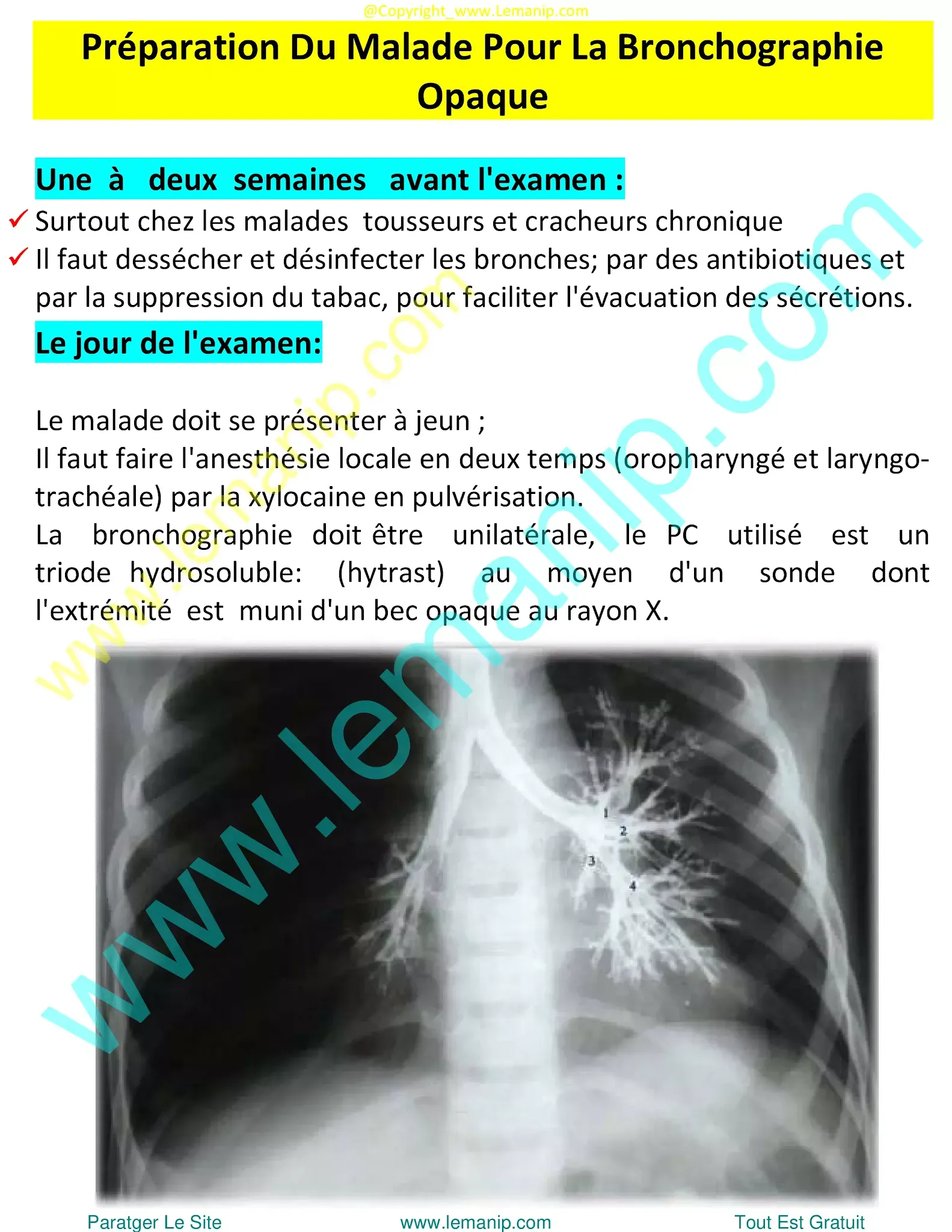 bronchoalveolar ca,lung lavage for copd,whole lung lavage,lung lavage,opdivo lung,restrictive airway disease,small airway disease,inflated lungs,hyperexpanded lungs,enlarged lungs