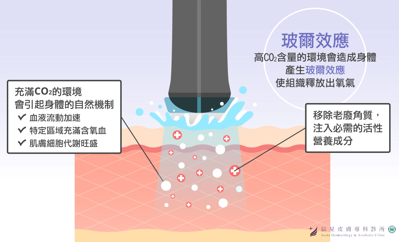 活氧泡泡是什麼