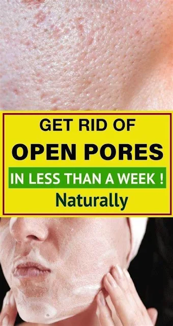 How To Make Pores Disappear With Only Natural Ingredients