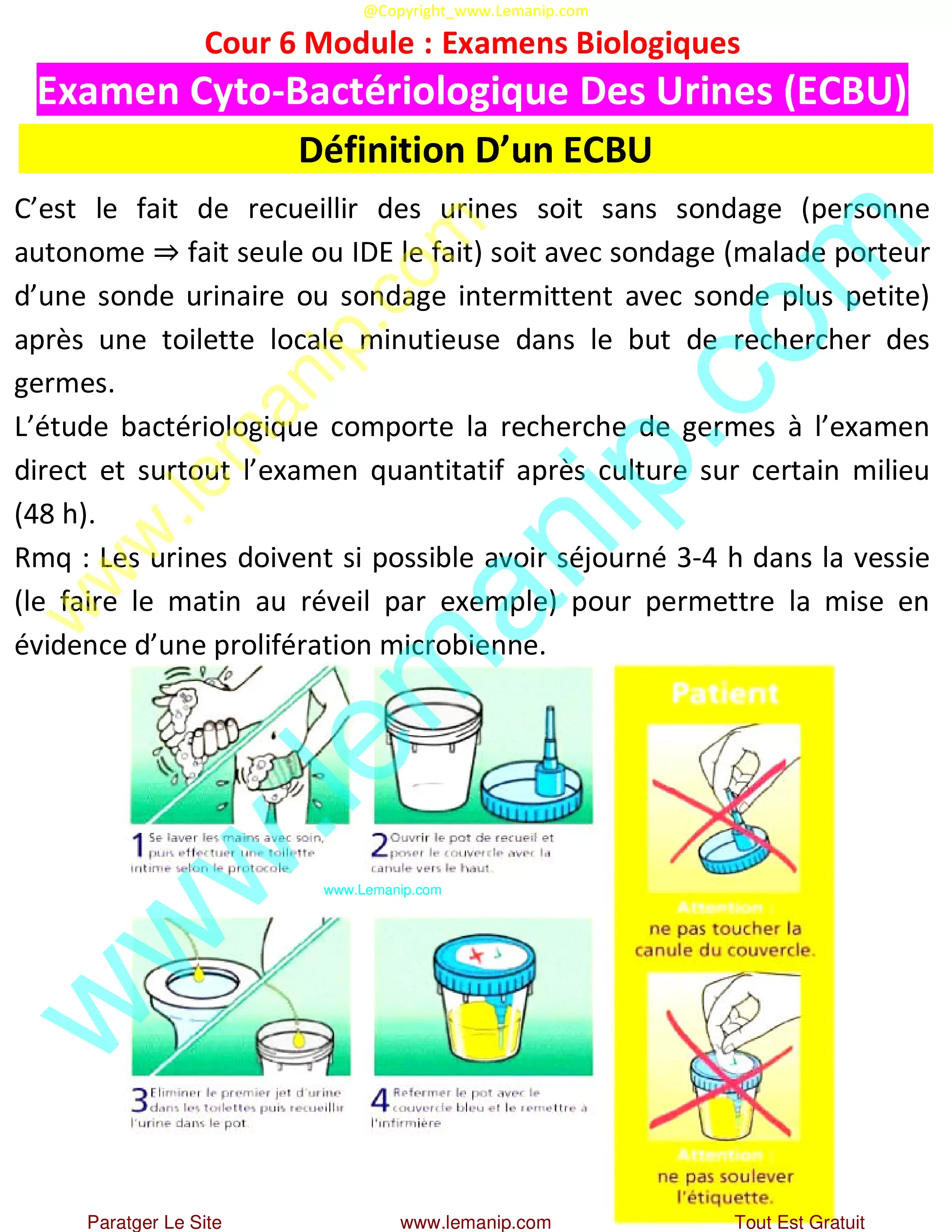 Comment interpréter les résultats d'une analyse d'urine (ECBU) ?