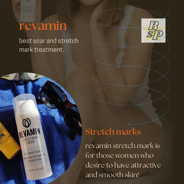 best stretch mark removal cream during pregnancy