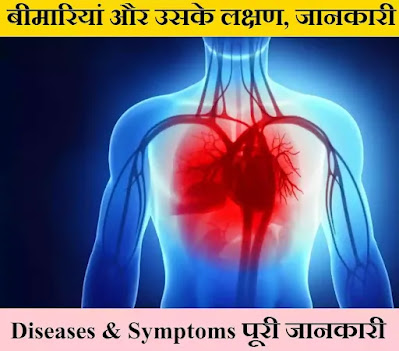 रोग और लक्षण - Diseases and Symptoms | रोग के लक्षण | Diseases & Symptoms पूरी जानकारी