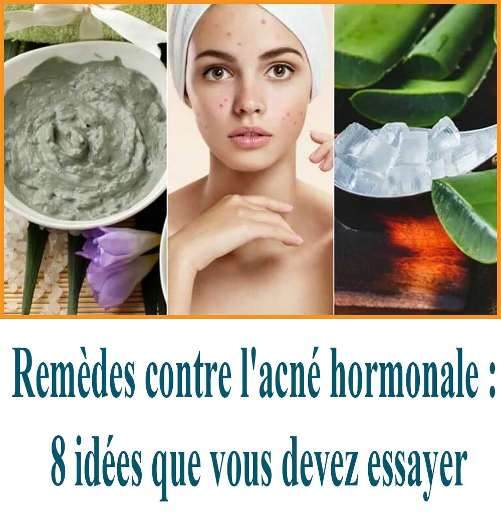 Remèdes contre l'acné hormonale : 8 idées que vous devez essayer