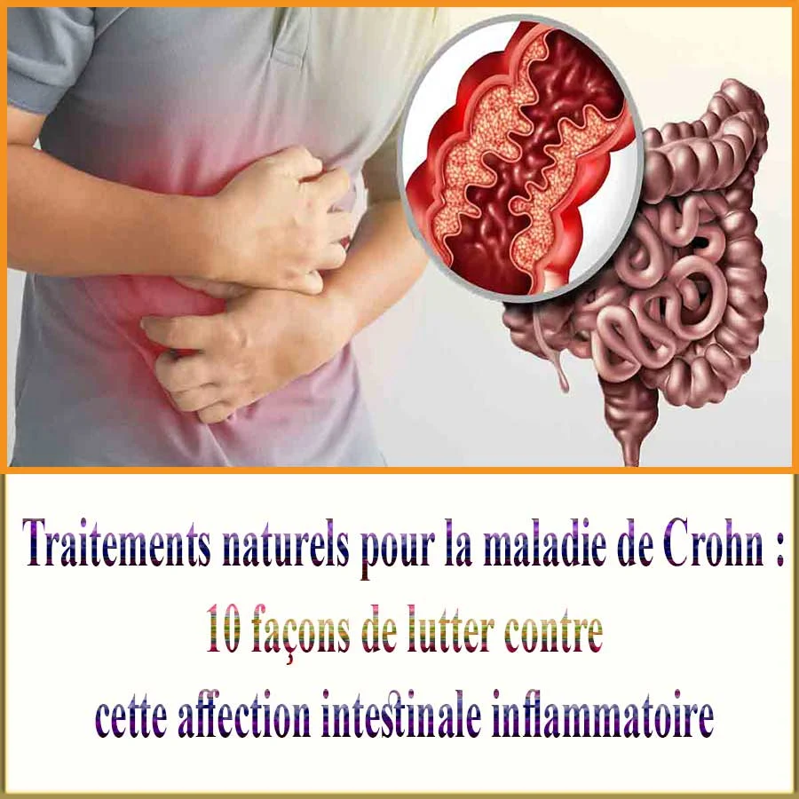 Traitements naturels pour la maladie de Crohn : 10 façons de lutter contre cette affection intestinale inflammatoire