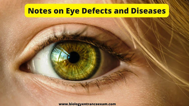 Notes on Eye Defects and Diseases