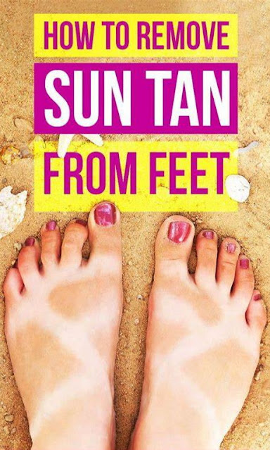 How To Remove Sun Tan From Feet