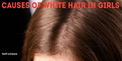 Causes of white hair in girls