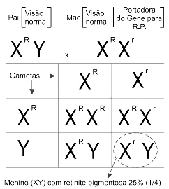 Nesta família a probabilidade de nascimento de um filho com retinite pigmentosa (RP) é de 25 % (1/4), conforme o cruzamento a seguir