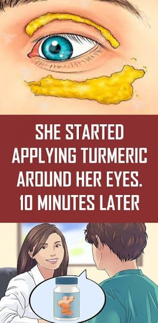 She Started Applying Turmeric Around Her Eyes, 10 Minutes Later Unbelievable