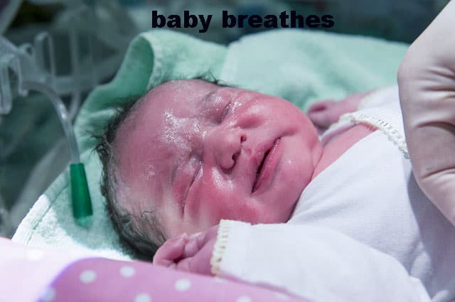 آباء المستقبل - عندما يتنفس الطفل لأول مرة