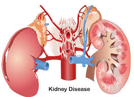 kidney ki samsya ke liye gharelu tips