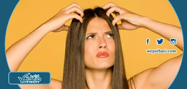 أفضل الطرق الطبيعية لعلاج القشرة في الشعر بفعالية