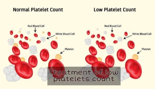 Diagnosis of low platelets count | Treatments of low platelets count | Low platelets problem 