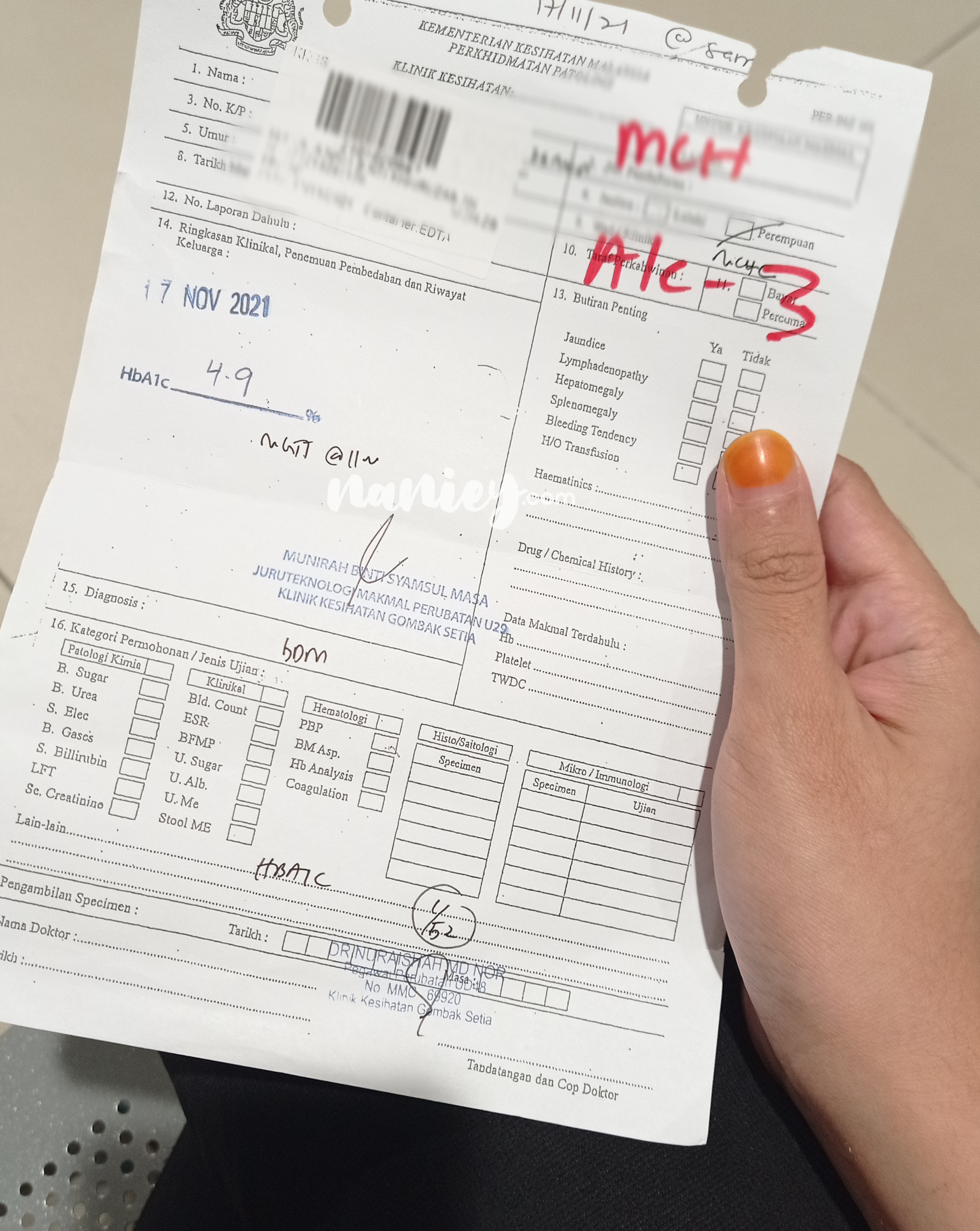 Result Normal HbA1c