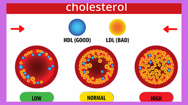 Causes of high cholesterol