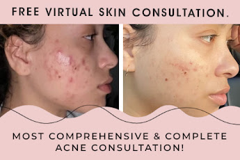 Whether you're dealing with acne or looking for a solution, Alluring Skin & Beauty has the answers!