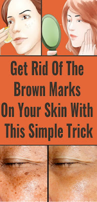 Get Rid Of The Brown Marks On Your Skin With This Simple Trick