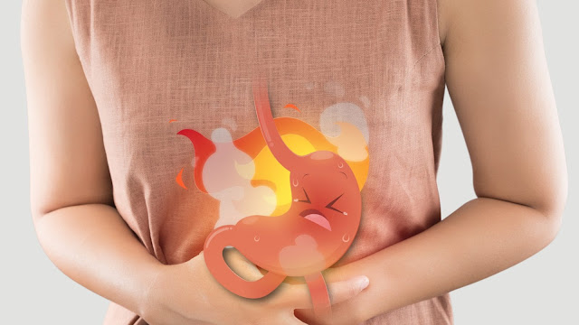how to get rid of heartburn naturally,