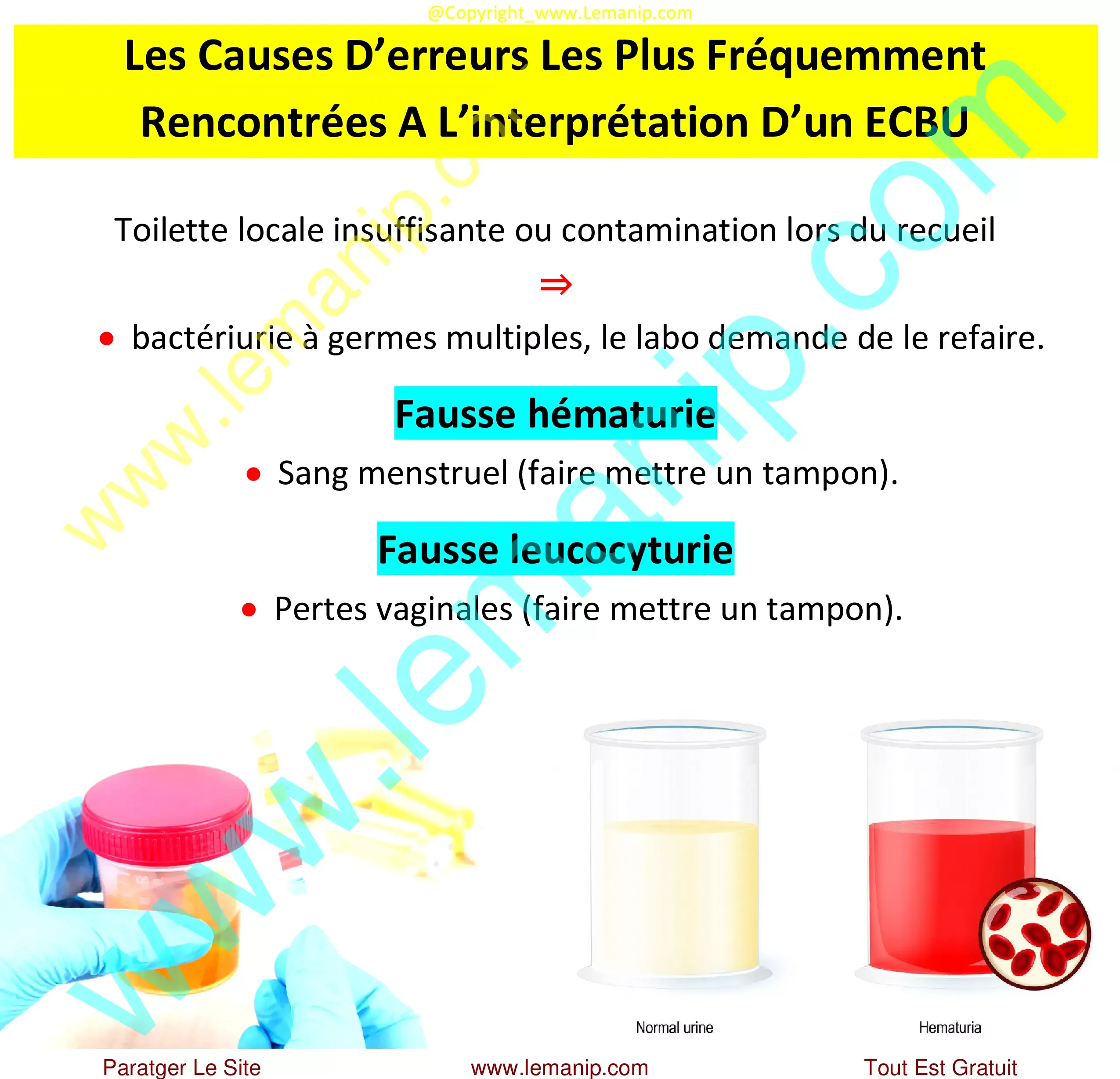 Causes erreurs ECBU