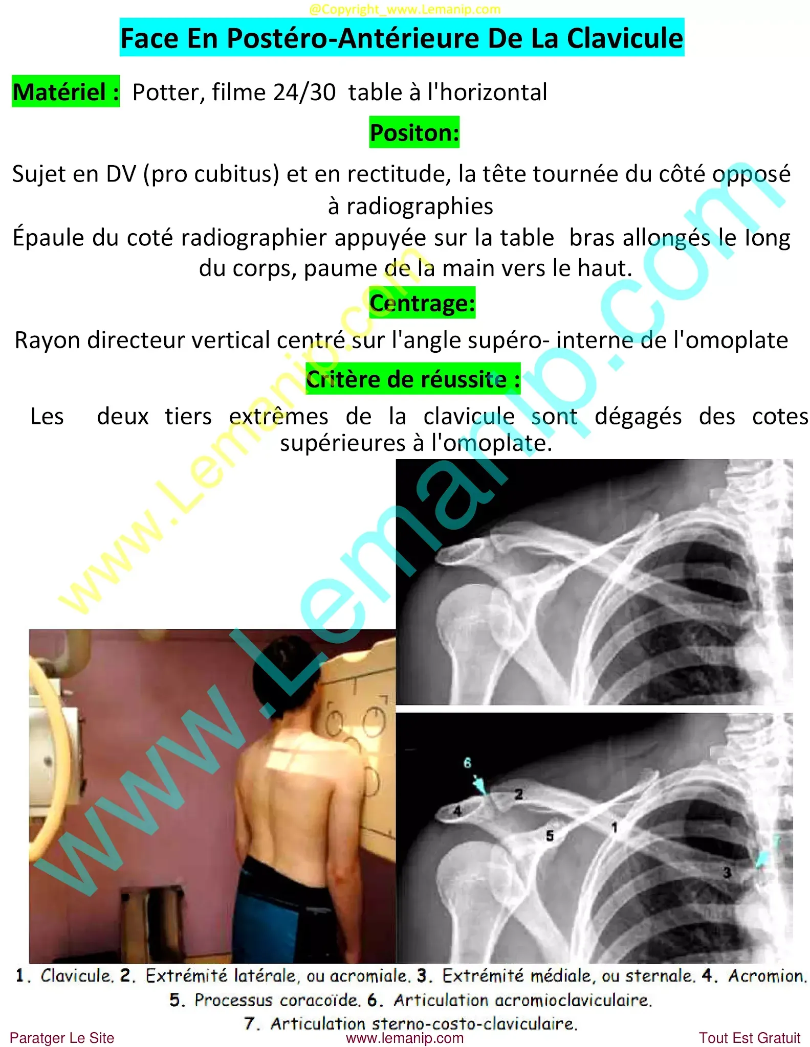 clavicle fracture at birth,broken collarbone at birth,shoulder and knee doctor,newborn clavicle fracture,newborn broken clavicle,infant clavicle fracture,broken clavicle at birth,newborn broken collarbone,infant broken clavicle,shoulder reliever