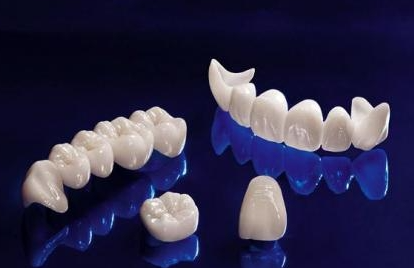 Răng sứ Zirconia là răng sứ toàn sứ có chi phí thấp nhất