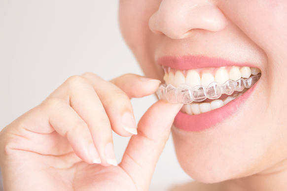 Teeth aligners