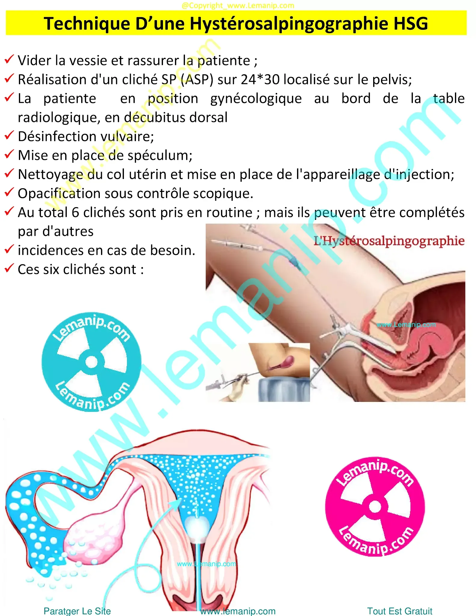 hysterosalpingography preparation,genetic testing female infertility,fl hysterosalpingography,xr hysterosalpingography,best female fertility test,camp lejeune infertility,female fertility clinic,women's infertility clinic,women's fertility clinic,fertility clinic for women