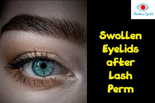 swollen-eyelids-after-lash-perm
